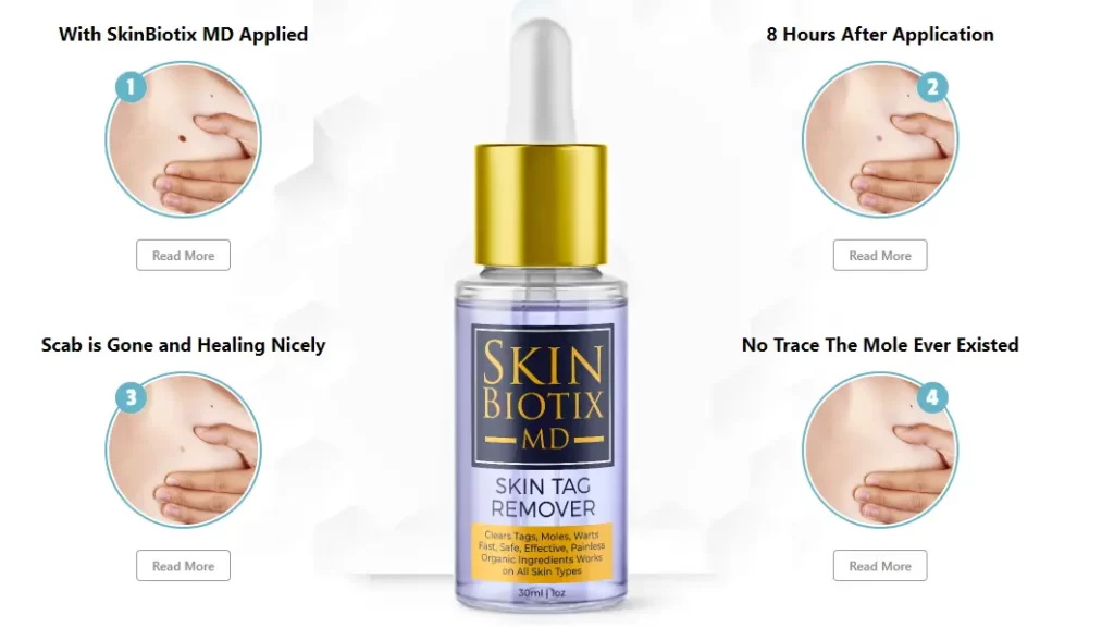 Utopia Skin Tag Remover-how-it-works